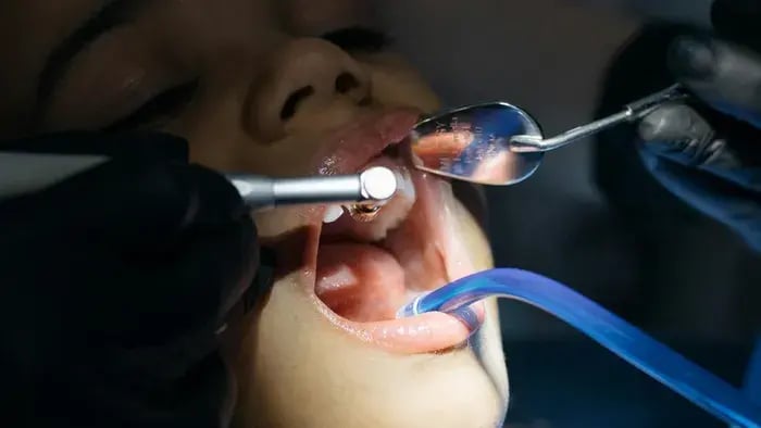 Regular Dental Checkups
