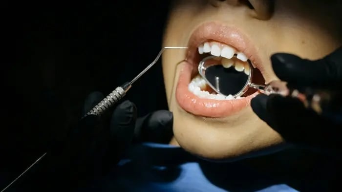 Cavities In Kids