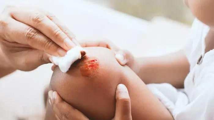 How to Manage Sports Injuries and Teach Kids About Safety - Be Positive