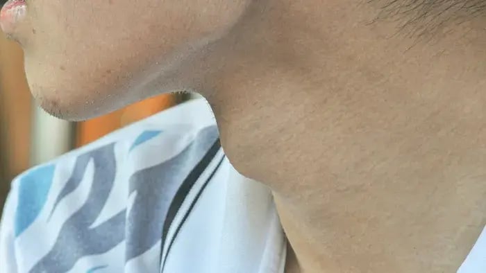 Adam's Apple